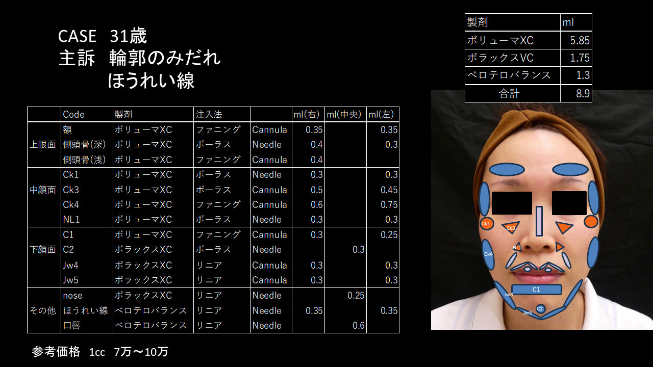 30代女性の症例写真2