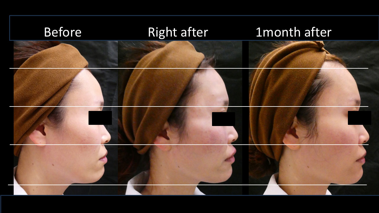 30代女性の症例写真6