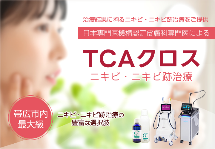 帯広でニキビ跡の凹凸（アイスピック型）にお悩みならグリーン皮膚科クリニック｜TCAクロス治療