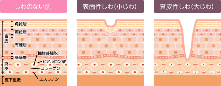 しわ・小じわが出来る理由とメカニズム