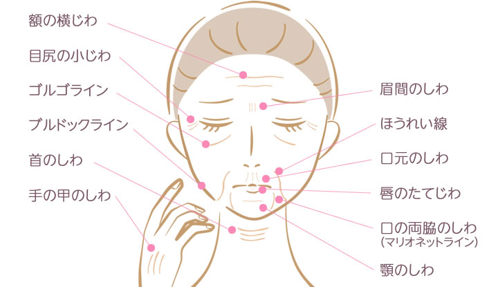 しわ・小じわ治療の種類と特徴の解説