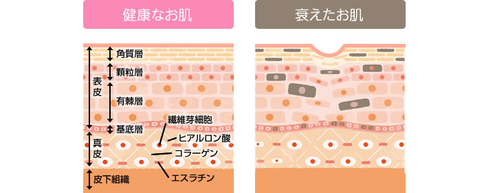 たるみが出来る理由とメカニズム